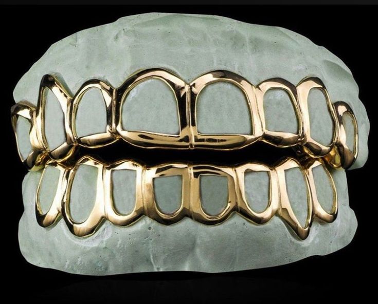 What Are Grillz? Your Ultimate Guide to Custom Gold &amp; Diamond Teeth