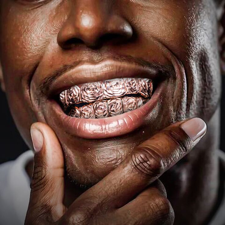 Why Rose Gold Teeth Caps Are the Hottest Trend in Custom Grillz