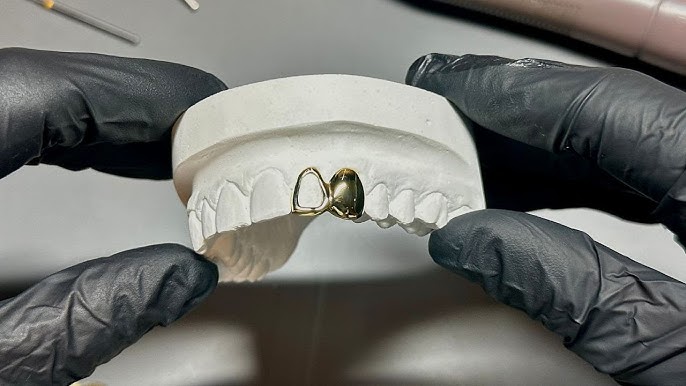Inside the Making of Custom Grillz: Craft, Precision, and Art