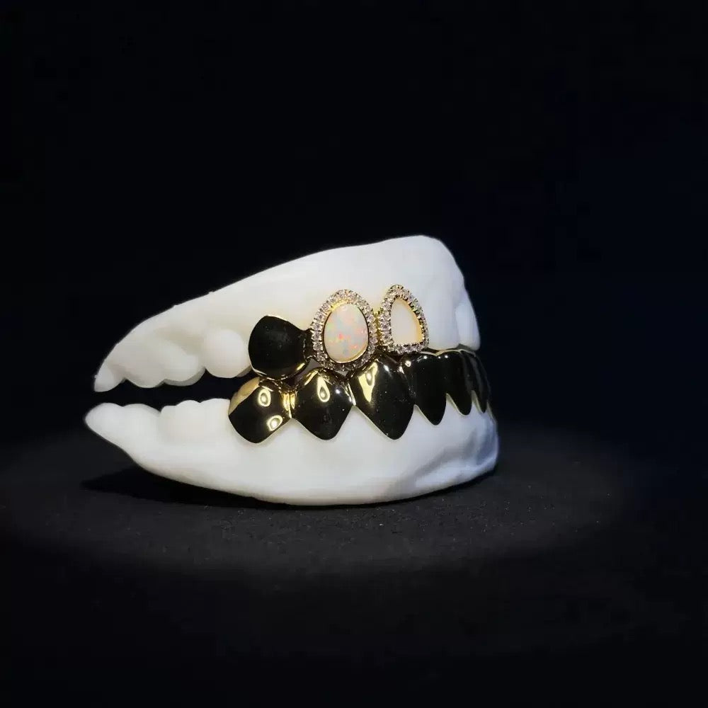 Custom Grillz & Opal Polished Gold Grillz
