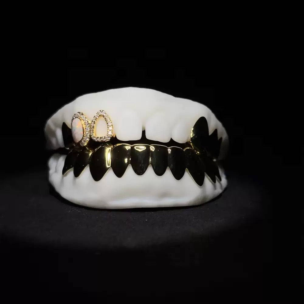 Custom Grillz & Opal Polished Gold Grillz