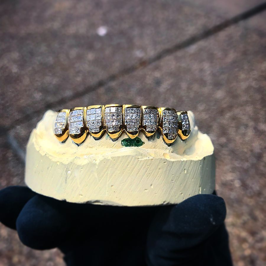 Hot-selling custom grillz