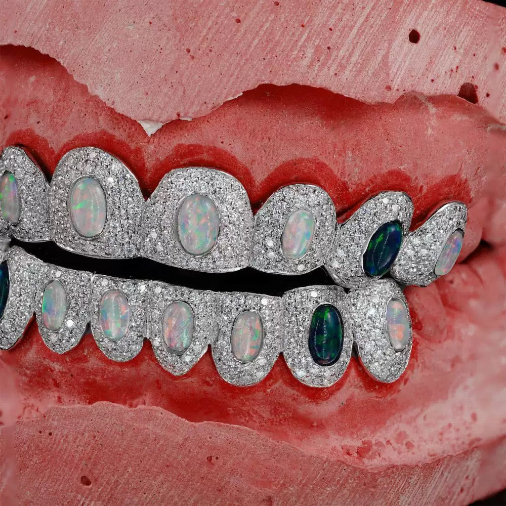 Custom Grillz & Opal Diamond Grillz