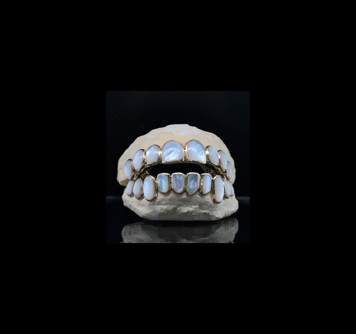 Custom grill & White Mother of Pearl grillz
